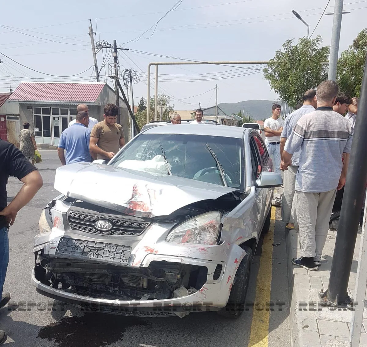 Oğuzda iki avtomobil toqquşub, xəsarət alan var