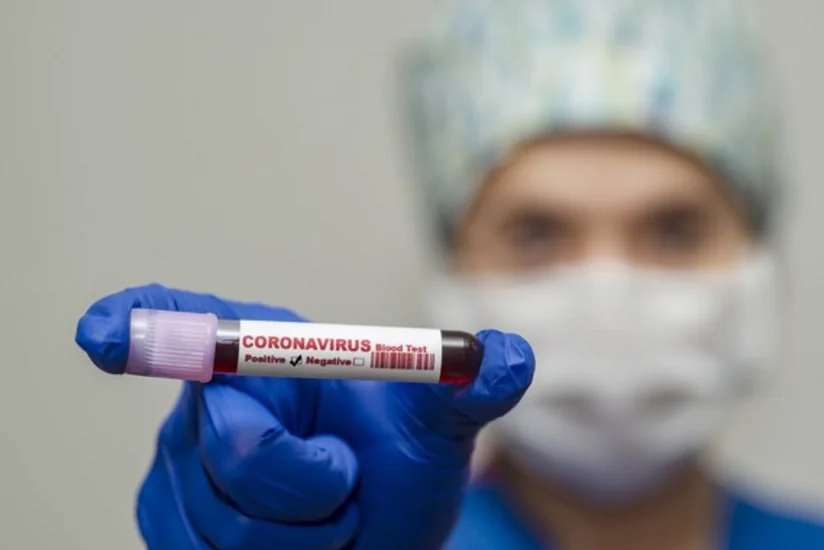Число случаев COVID-19 в Армении превысило 18 тысяч