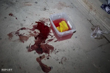 “Araz” marketin satıcısı iş yoldaşlarını bıçaqlayıb, onlardan biri ölüb - FOTO - VİDEO - YENİLƏNİB-2