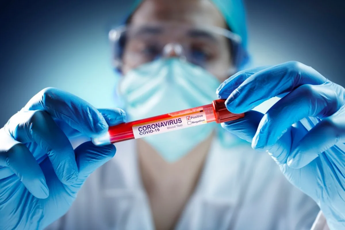 Azərbaycanda daha 101 nəfərdə koronavirus aşkarlandı, 53 nəfər sağaldı