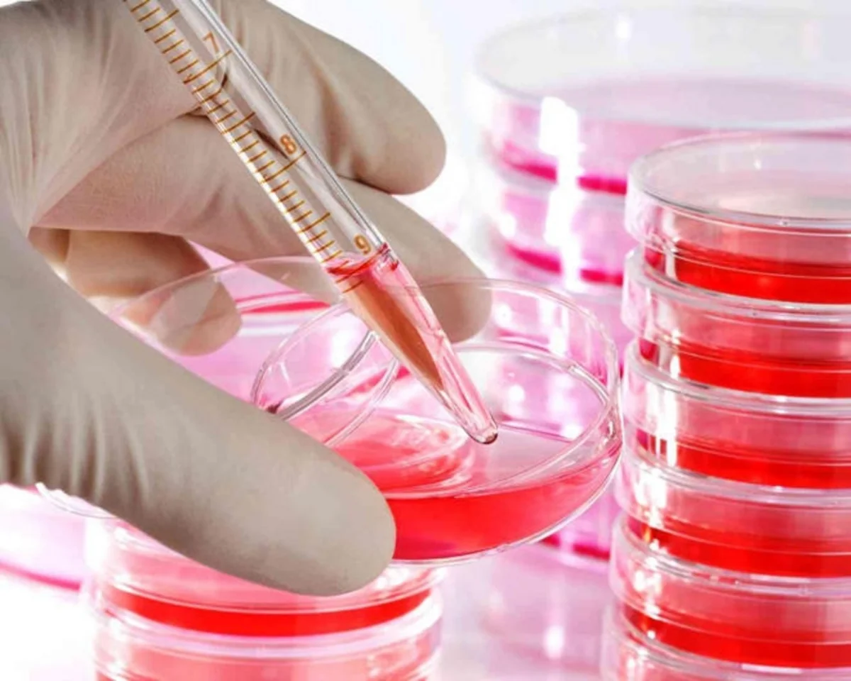 Azerbaijan records 736 HIV cases in 6 months