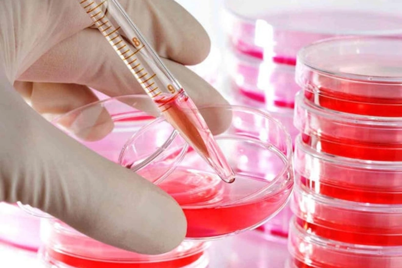 Azerbaijan records 736 HIV cases in 6 months