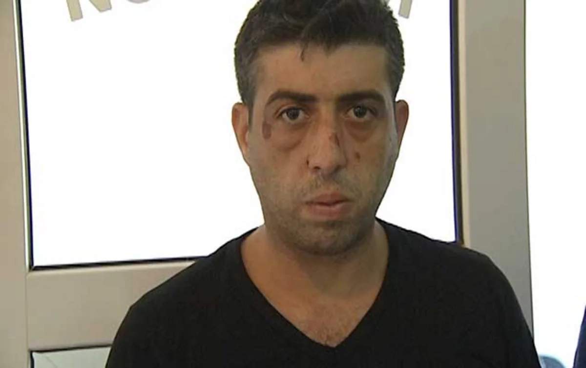 Aygün Bəylərin qardaşı ilə birgə təqsirləndirilən şəxs müalicə müəssisəsinə yerləşdirilib