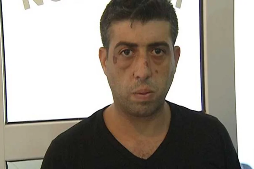 Aygün Bəylərin qardaşı ilə birgə təqsirləndirilən şəxs müalicə müəssisəsinə yerləşdirilib