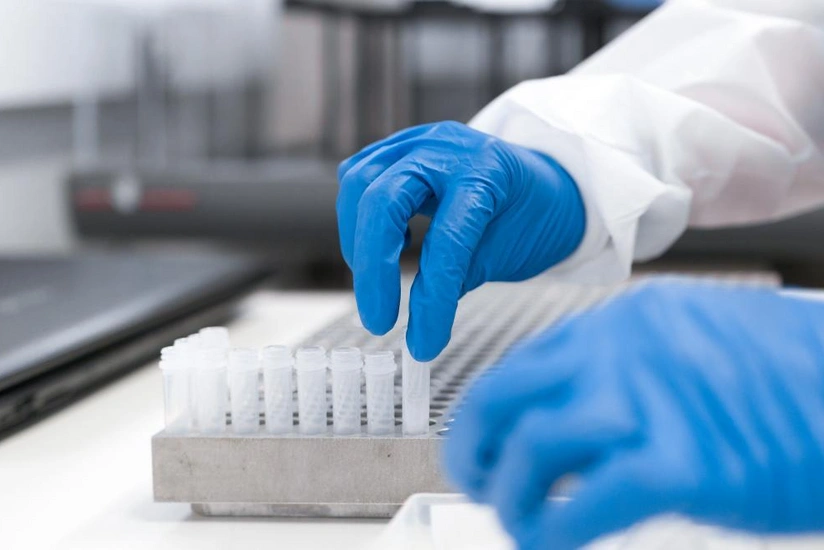 Azərbaycanda koronavirusla bağlı testlərin sayı 200 mini keçdi - RƏSMİ