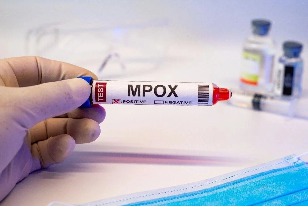 Meymunçiçəyi epidemiyasına qarşı qlobal cavab tədbirləri görülməlidir