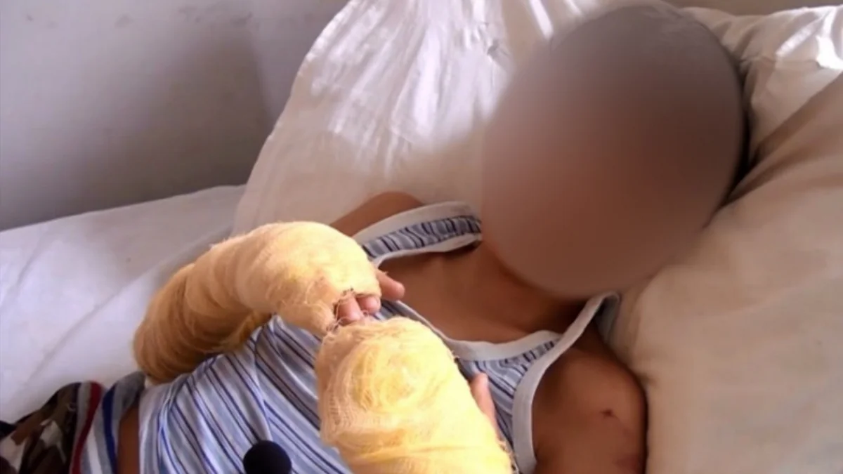 Bərdədə uşağın əllərini yandıran ana barədə cinayət işi açılıb