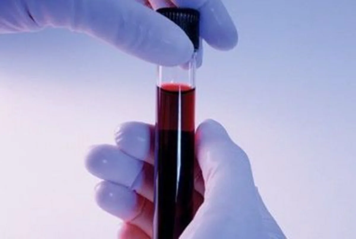 Netherlands wants to grow human embryos for ‘limited’ research