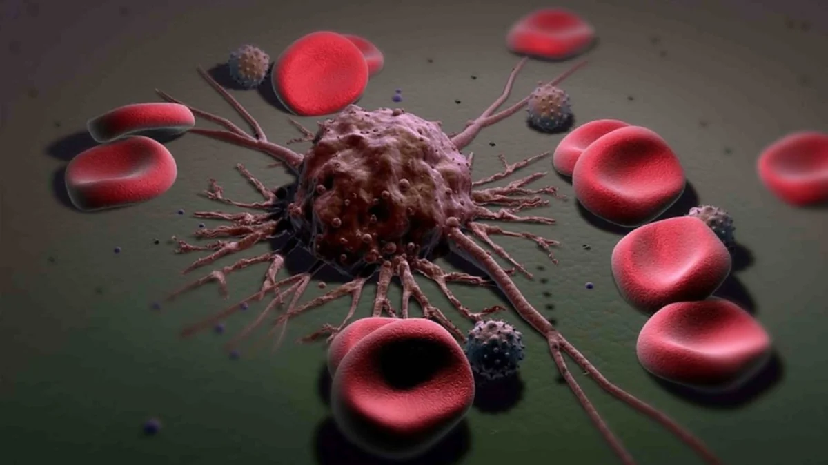 Ученые нашли способ побороть метастазы рака