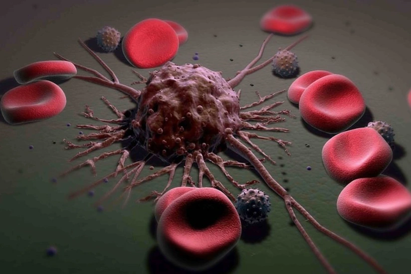 Alimlər xərçəng xəstəliyinin metastazına üstün gəlmək üsulunu tapıblar