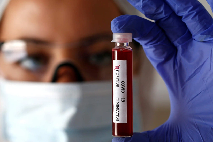 Dünyada COVID-19-a yoluxanların sayı 22 milyona yaxınlaşdı