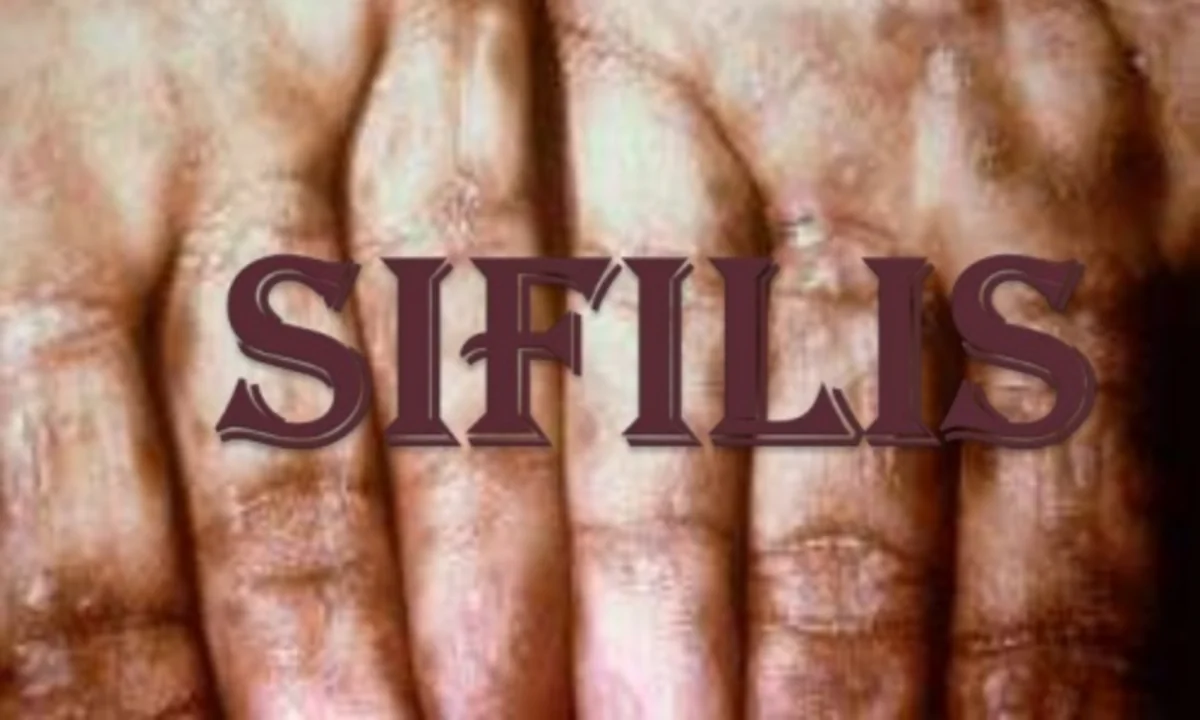 Azərbaycanda qeydiyyatda olan sifilis xəstələrinin əksəriyyəti kişilərdir