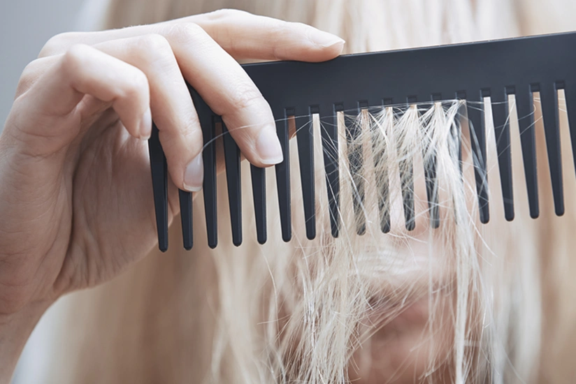 Saç tökülməsinin qarşısını necə almaq olar?