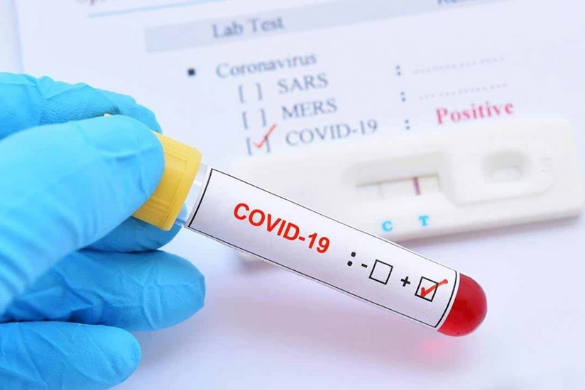 Azerbaijan records 3 new COVID cases