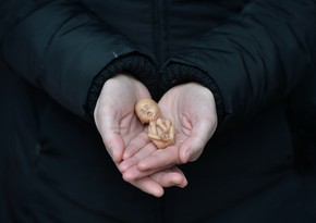 Parlament qanunsuz aborta görə cəzaların sərtləşdirilməsini son oxunuşda təsdiqləyib