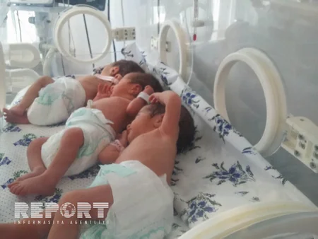 ​Bərdədə 10 ildir övladı olmayan ailənin üçəm qızları dünyaya gəlib - FOTO