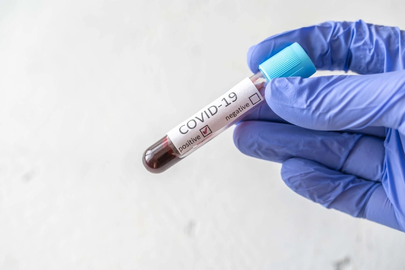 New strain of coronavirus found in Russia