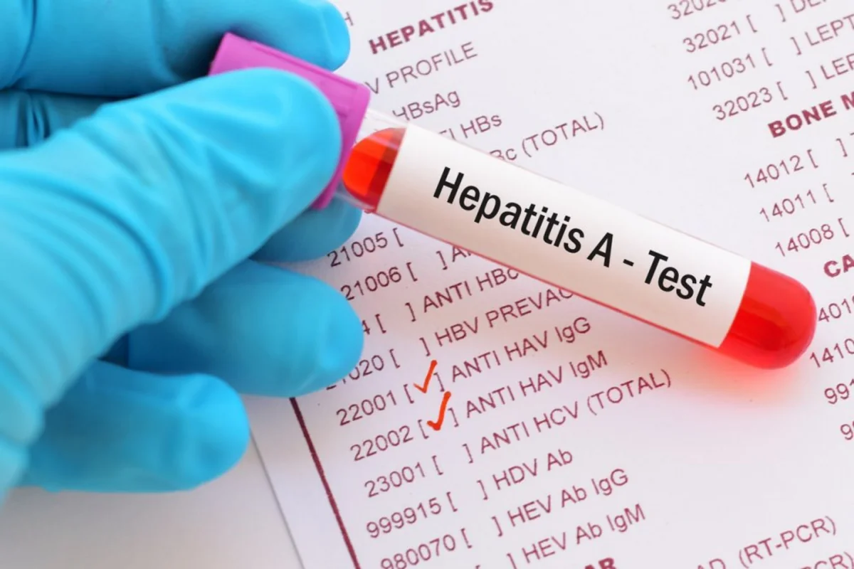 Azərbaycanda Hepatit A virusu ilə bağlı son vəziyyət açıqlanıb