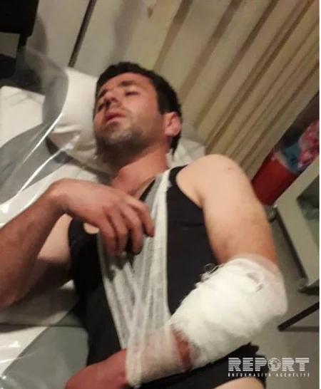 Kürdəmir sakini həmkəndlilərinə bıçaq xəsarətləri yetirib - FOTO