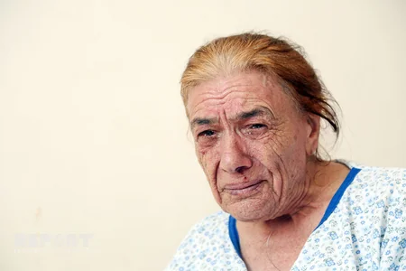 Xəstənin sağlam ayağını kəsən həkim: “Hər iki ayaq kəsilməli idi” - EKSKLÜZİV