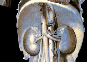 “Liver International”: Böyrəklər hepatit E virusunu gizlədə bilər