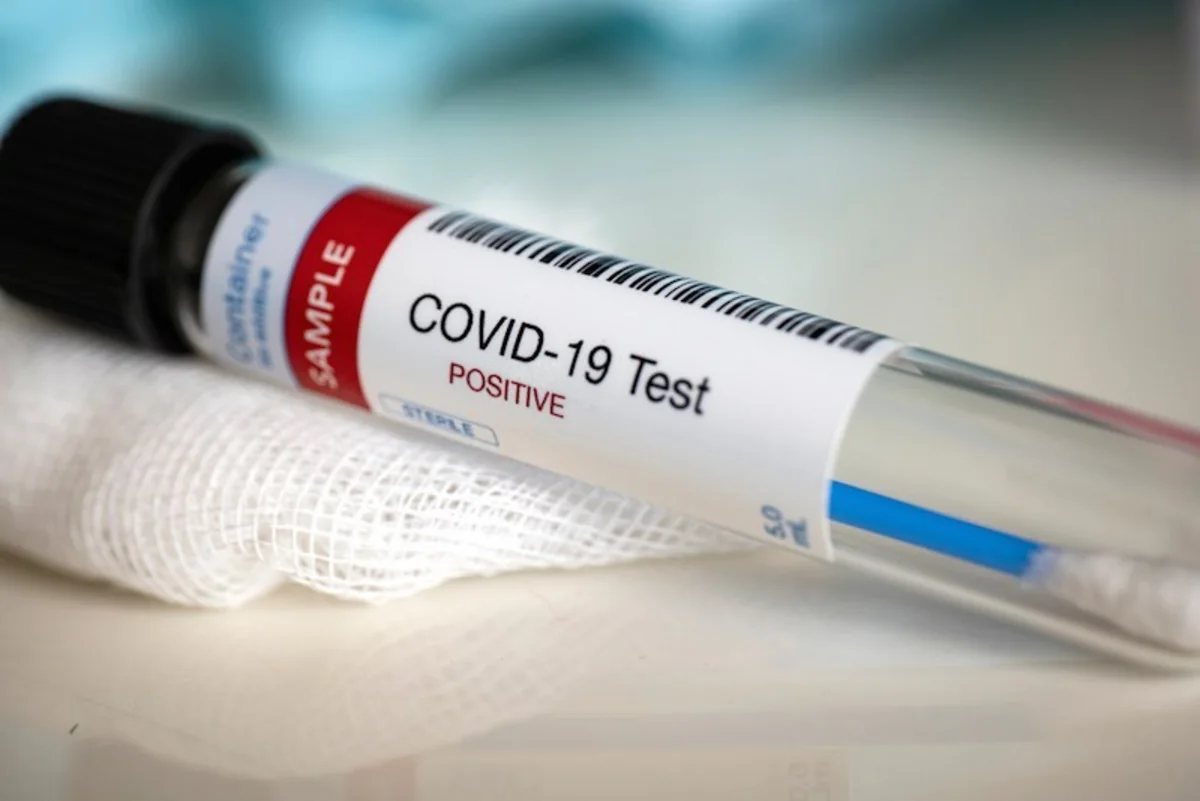 Azerbaijani official infected with coronavirus