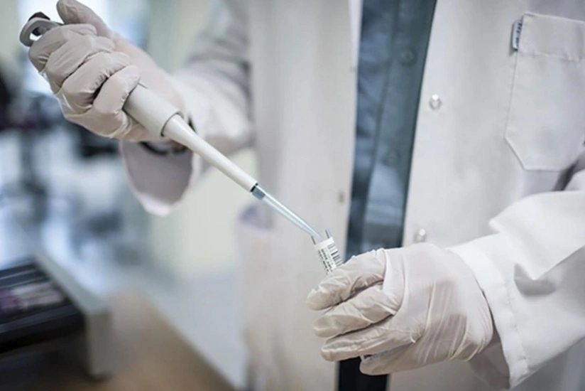 Daha bir ölkədə meymunçiçəyinə yoluxma aşkarlanıb