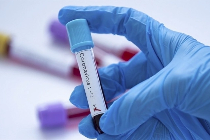 İrandan qayıdan daha üç azərbaycanlıda koronavirus aşkarlandı