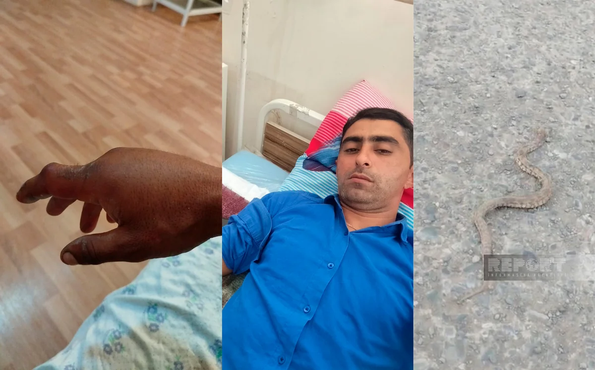 Ağdamda 32 yaşlı kişini ilan sancıb