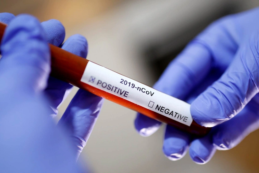 Azerbaijan reports 3 new COVID-19 cases