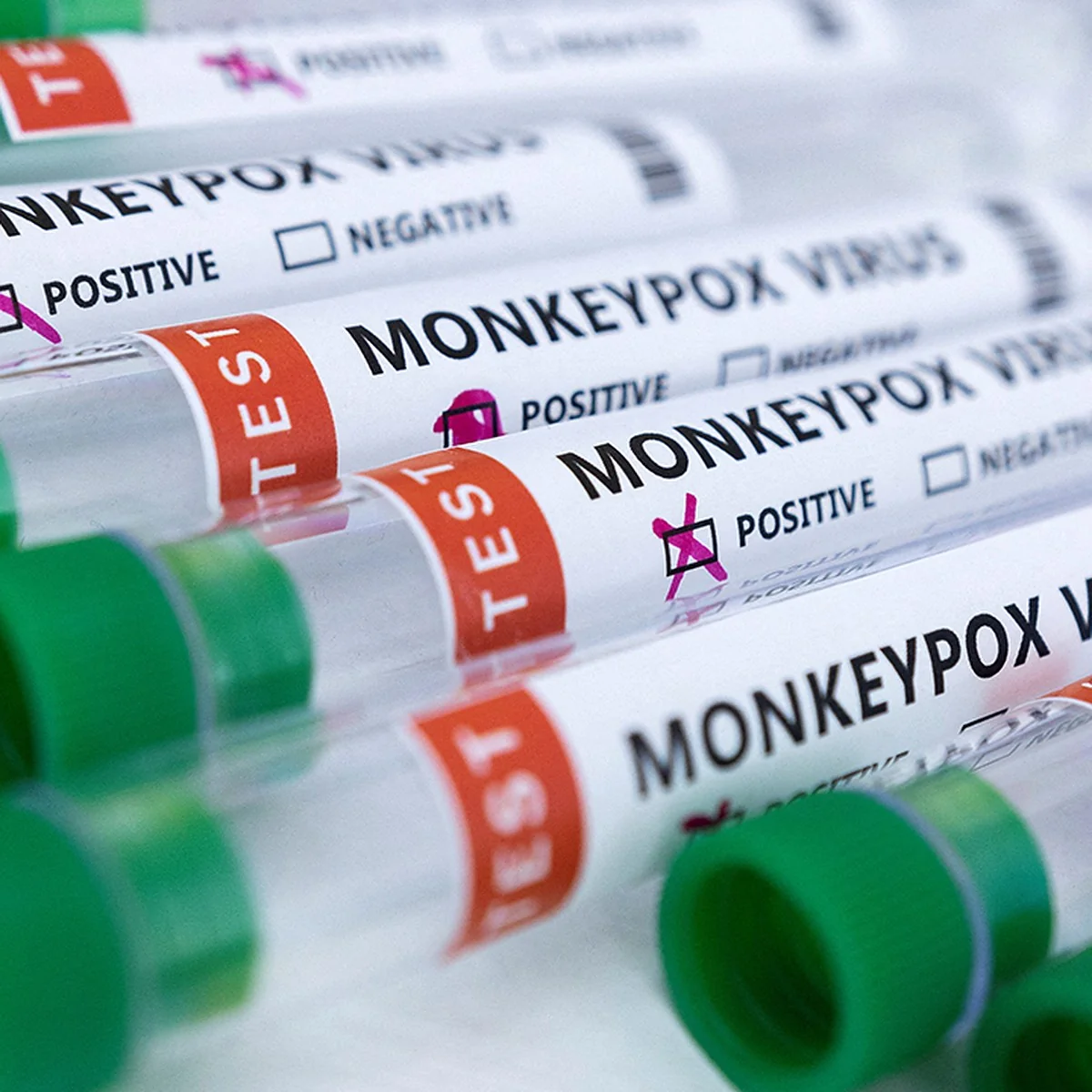 Spain reports second monkeypox-related death in Europe