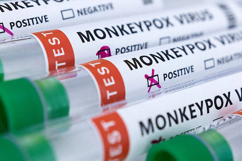 В Испании зафиксирован второй случай смерти от оспы обезьян