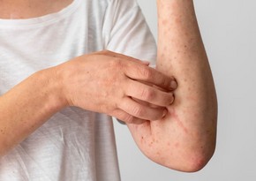 Scientists develop antibody to stop sepsis