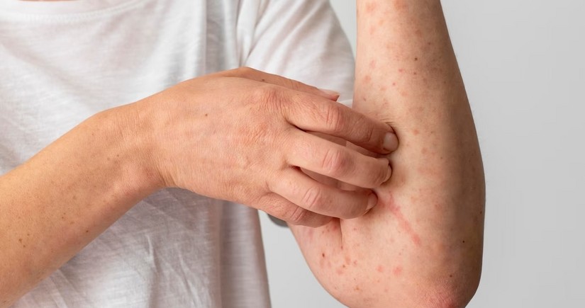 Scientists develop antibody to stop sepsis