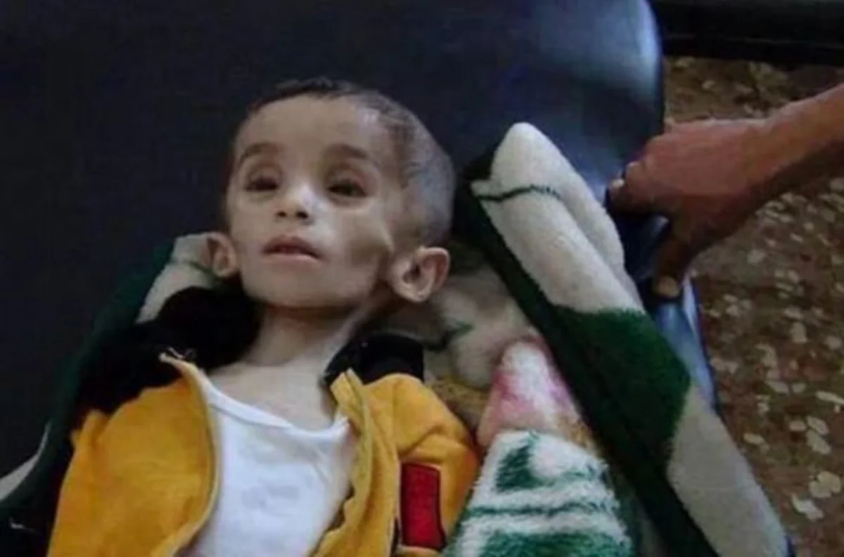 ​Suriyada mühasirədə olan şəhərə ilk humanitar yardım göndərilib