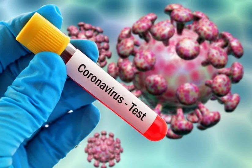 Koronavirus testləri Azərbaycanda kimlərə tətbiq olunacaq? - AÇIQLAMA