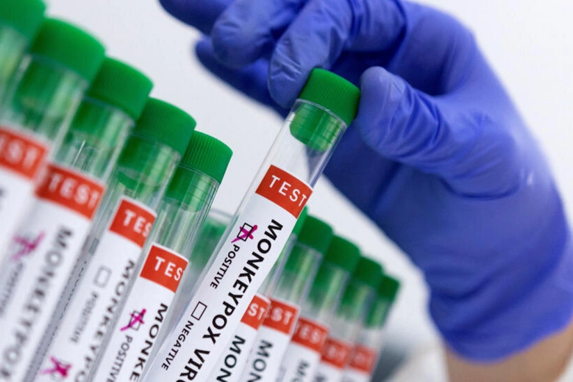 Thailand detects first case of new mpox virus infection