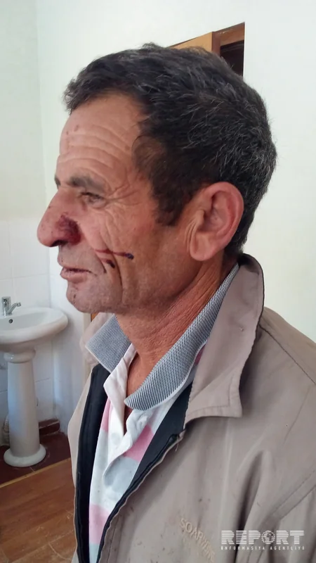 Şamaxıda kütləvi dava: Ər-arvad döyülüb - FOTO