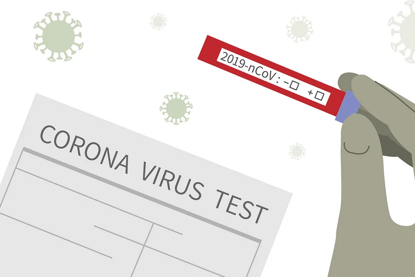 Deputatlar yenidən koronavirus testindən keçəcəklər