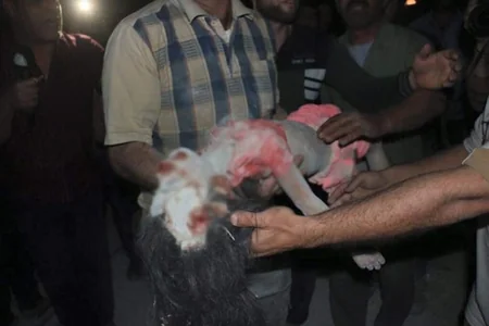 ​Rusiya qırıcıları Hələbin ən böyük xəstəxanasını bombalayıb, 53 dinc sakin həlak olub