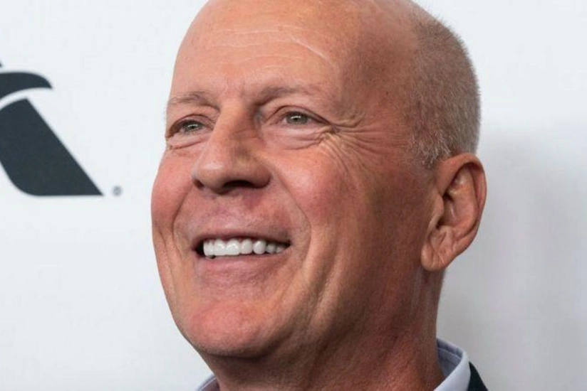 Hollywood star diagnosed with frontotemporal dementia