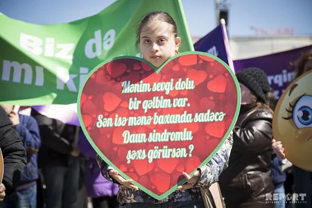Bu gün Beynəlxalq Daun Sindromu Günüdür - FOTOREPORTAJ
