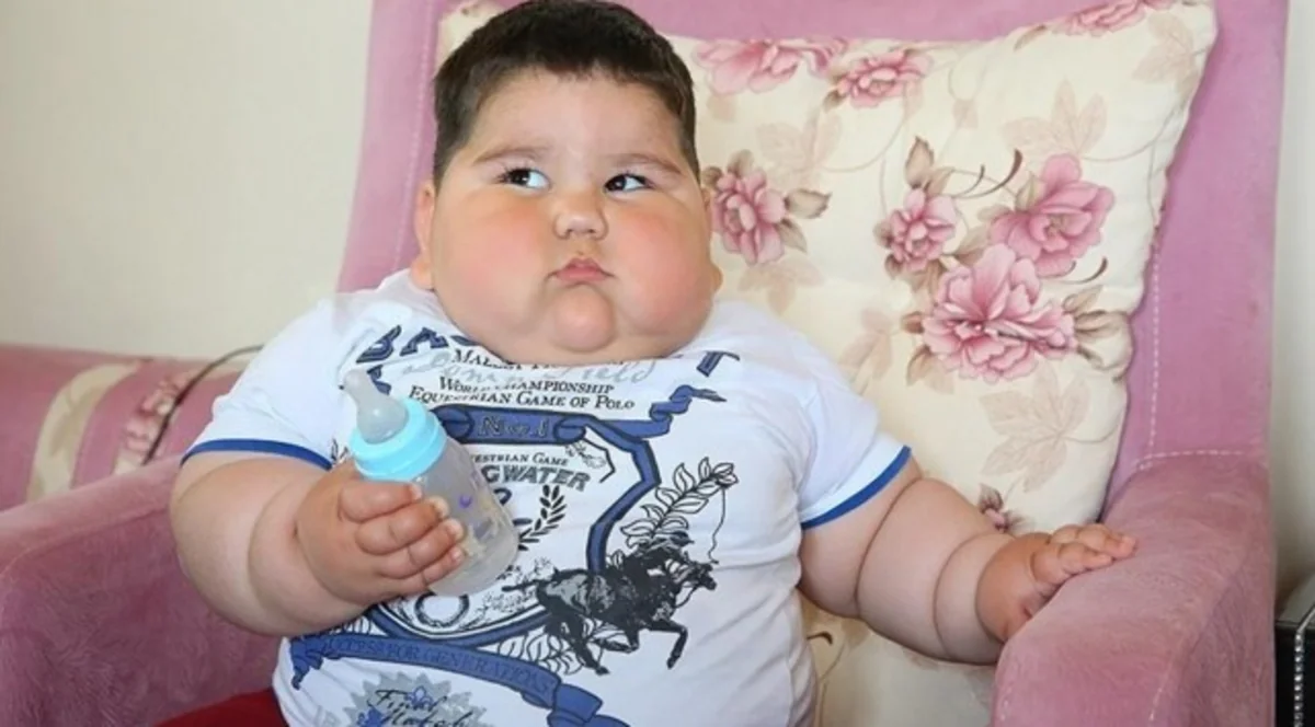 BMT: Dünyada 5 yaşdan aşağı 40 milyon uşaq artıq çəkidən əziyyət çəkir