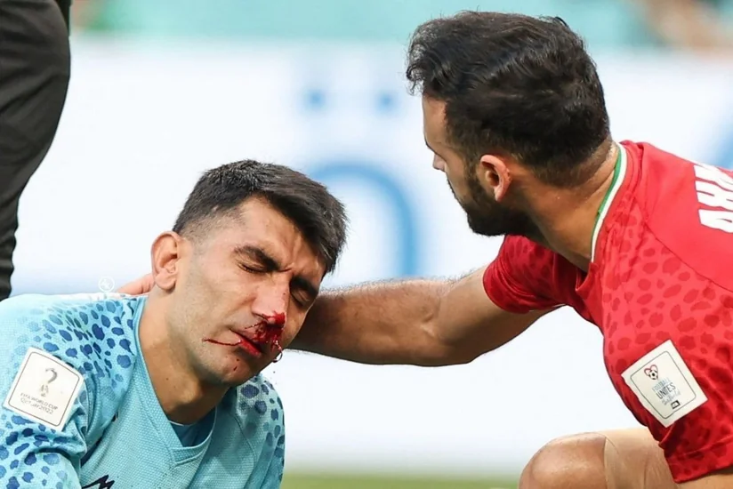 DÇ-2022: İran millisi ciddi itki ilə üzləşib