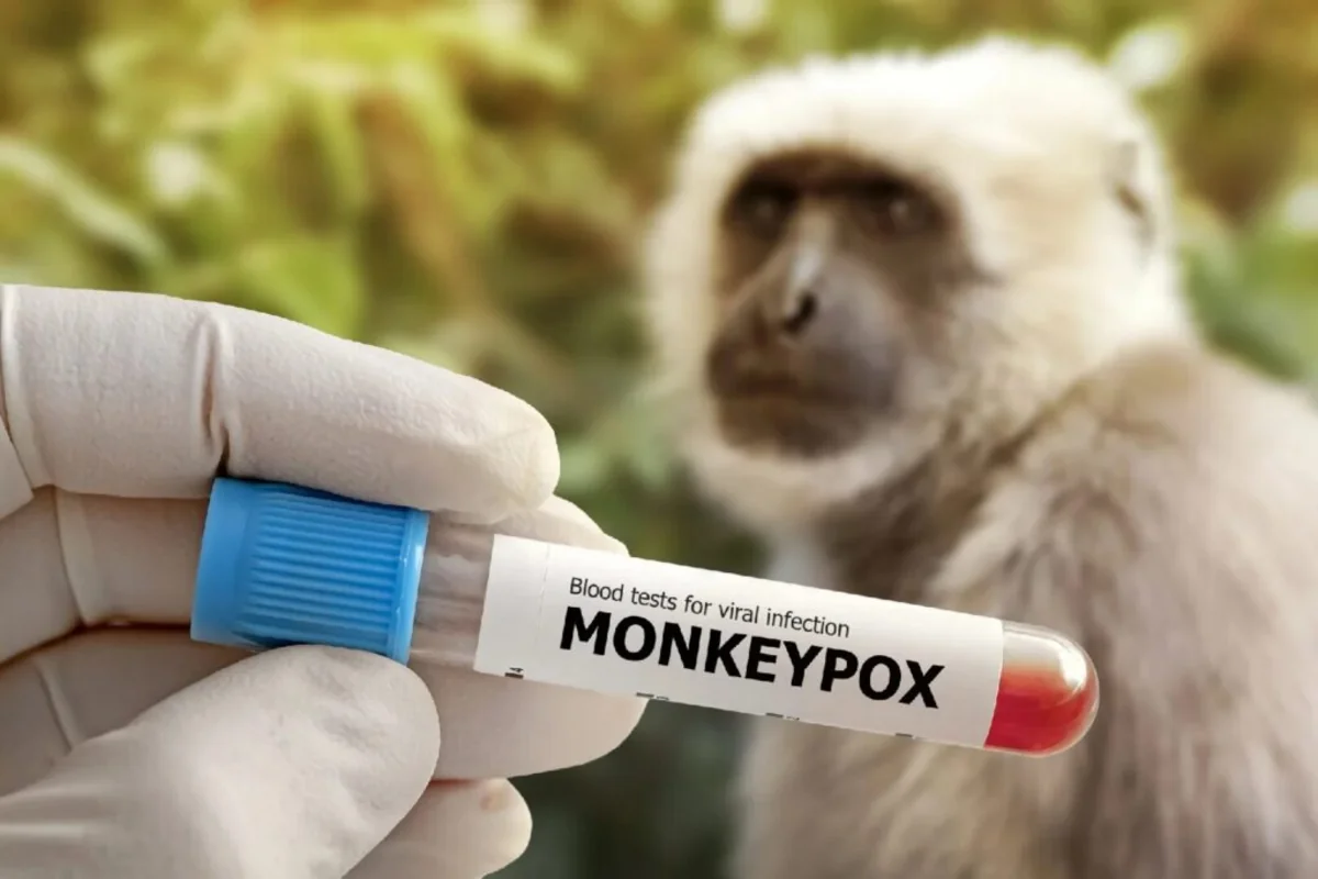 ДР Конго выделит $49 млн на борьбу с mpox
