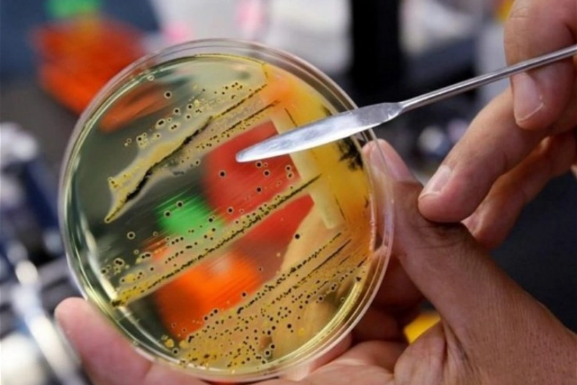 Six deaths reported in cantaloupe salmonella outbreak in Canada