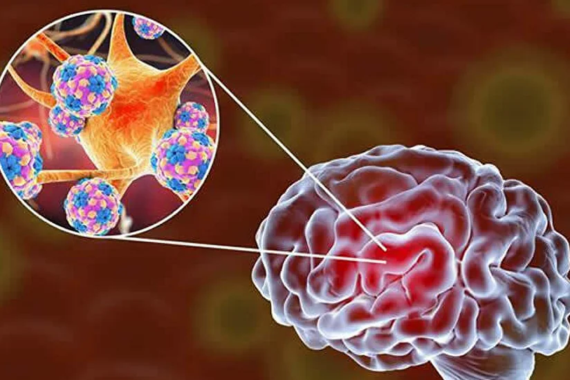 Ученые объяснили проблемы с мозгом у больных COVID-19