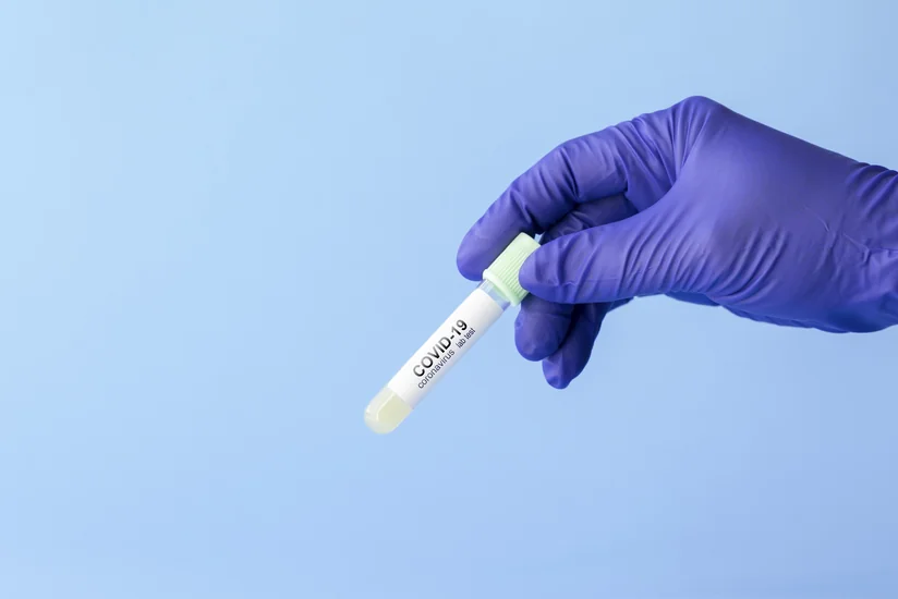 Task Force: Nine more die of COVID-19 over the past day