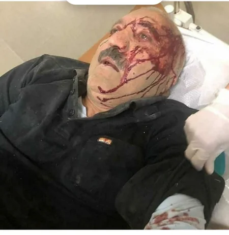 Xilasedicilər Gəncədə dağıntılar altından 52 yaralı və 13 meyit çıxarıb