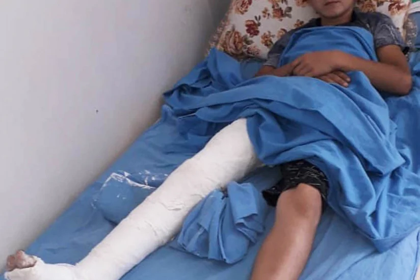 Kürdəmirdə 15 yaşlı oğlan atdan yıxılaraq ağır xəsarət alıb - FOTO